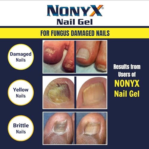 Fungal Nail Clarifying Gel | Rids Nails of Fungus by Removing Keratin Debris Where Nail Fungus Grows | 90% of Toenails Improved Using this Toenail Fungus Treatment | 4 oz - Image 6