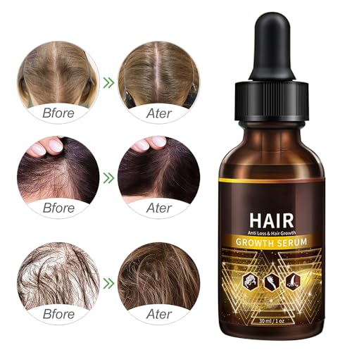 Roots Hair Growth Serum for Thicker, Healthier Hair - 2 oz Bottle - Image 7