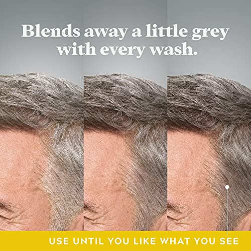 Healthy Scalp & Hair Growth Anti-Dandruff Shampoo for Hair Fall Control 300ml - Image 2