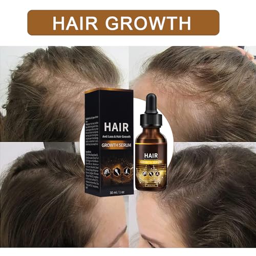 Roots Hair Growth Serum for Thicker, Healthier Hair - 2 oz Bottle - Image 5