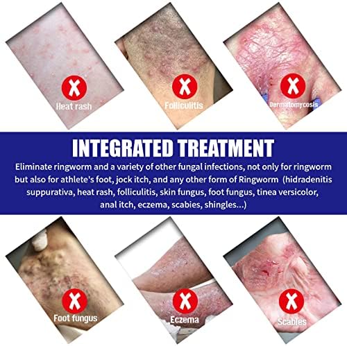 Gel nail break causes bleeding. - Image 7