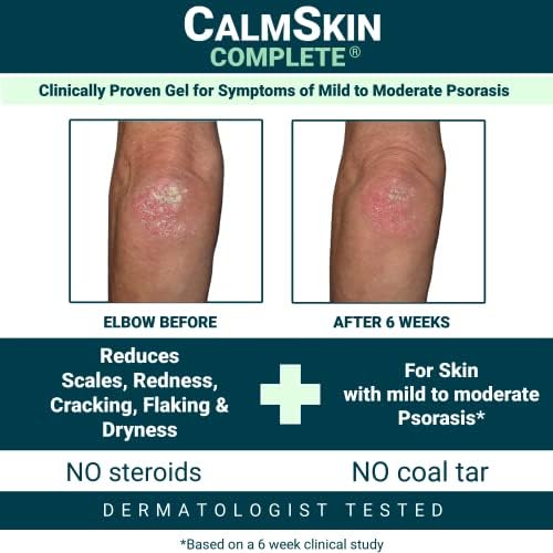 Dermatitis from Eye Cream - Image 2