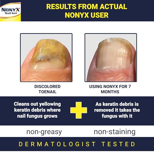 Fungal Nail Clarifying Gel | Rids Nails of Fungus by Removing Keratin Debris Where Nail Fungus Grows | 90% of Toenails Improved Using this Toenail Fungus Treatment | 4 oz - Image 3