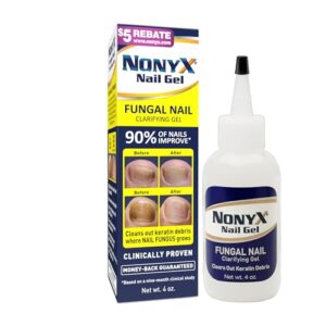 Fungal Nail Clarifying Gel | Rids Nails of Fungus by Removing Keratin Debris Where Nail Fungus Grows | 90% of Toenails Improved Using this Toenail Fungus Treatment | 4 oz