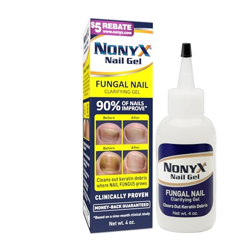Fungal Nail Clarifying Gel | Rids Nails of Fungus by Removing Keratin Debris Where Nail Fungus Grows | 90% of Toenails Improved Using this Toenail Fungus Treatment | 4 oz