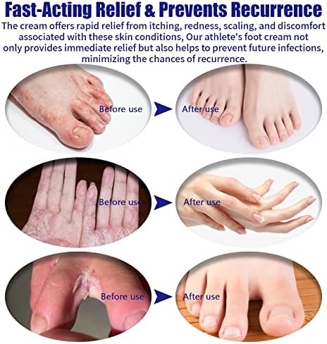 Gel nail break causes bleeding. - Image 6