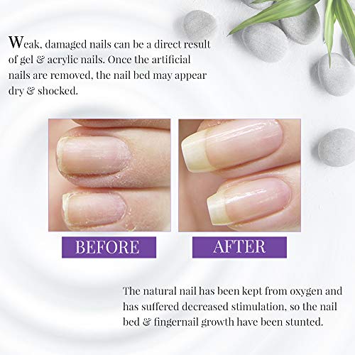 Strengthening Nail Growth Polish for Stronger, Healthier Nails - 15ml Capacity - Image 2