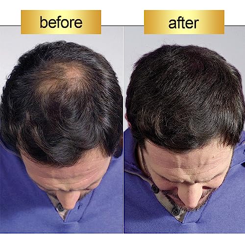 Premium Natural Human Hair Extensions: Detailed Structure and Properties for Superior Quality - Image 9