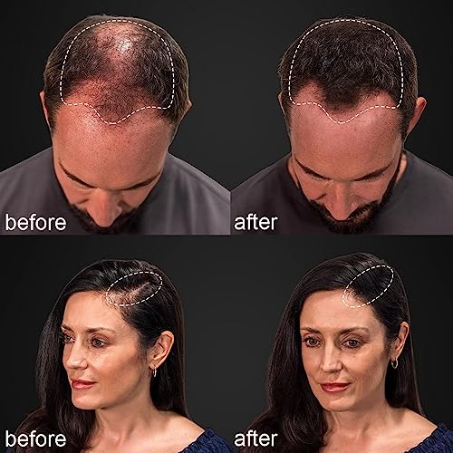 Premium Natural Human Hair Extensions: Detailed Structure and Properties for Superior Quality - Image 7