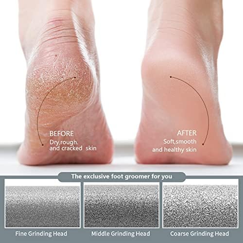 Professional Rechargeable Electric Foot Callus Remover Kit for Smooth Dead Skin Pedicure - Image 5
