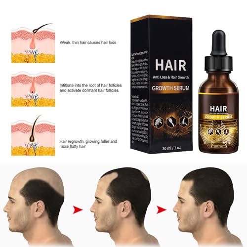 Roots Hair Growth Serum for Thicker, Healthier Hair - 2 oz Bottle - Image 6