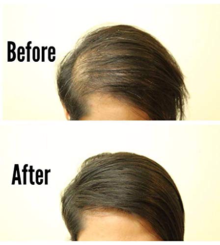 Toppik Spray Applicator: Easy Hair Styling - Image 4