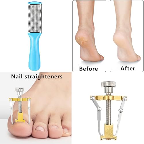13 Piece Professional Pedicure Tool Set for Ingrown & Thick Nails Men Women - Image 4