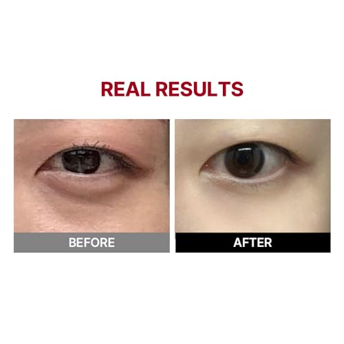 Wrinkle-fit Tangle Eye Cream, Chargable Device Tip + Protein Collagen Eye Cream, All-in-One Under Eye Treatment, 0.67 fl oz, Eye Massager for Dark Circles, Puffiness, Eyebags - Image 4