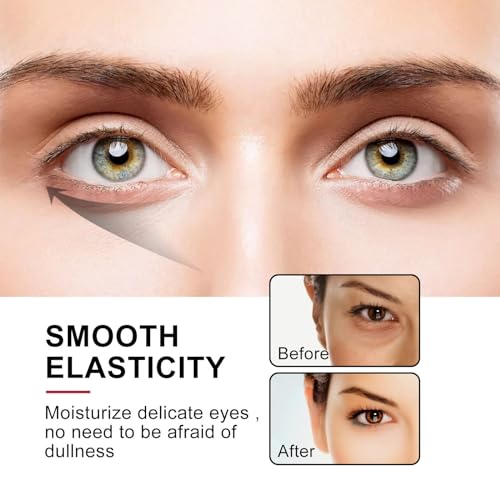 Ginseng Under Eye Roller Serum Oil for Dark Circles and Puffiness, 10ml - Image 3