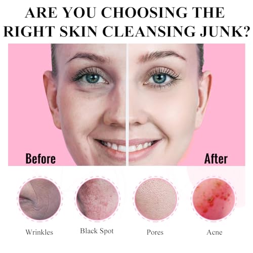 20 Pods Clay Facial Mask Set - Green Tea,Turmeric, Dead Sea Mud,Rose, 24K Gold,Eggplant,Avocado,Mud Mask Deep Pore Cleansing Acne Blackhead Removal,Men & Women Face Mask Skin Care. - Image 4