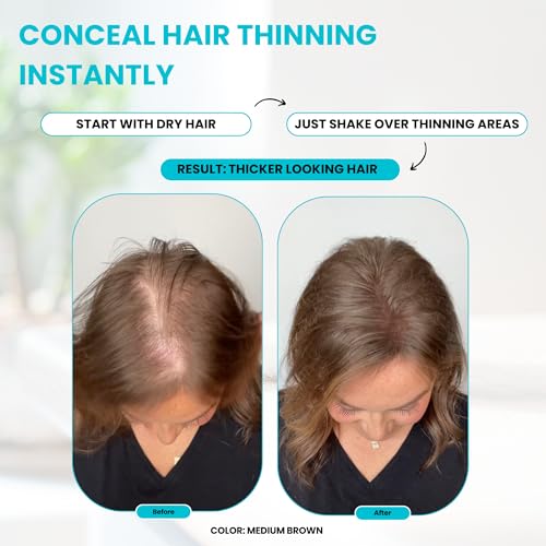 SURETHIK 30g Grey Hair Building Fibers for Instant Volume Thinning Hair Men Women - Image 2