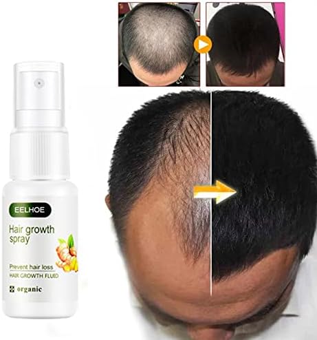 Ginger Spray, Ginger Hair Growth Spray, Ginger Spray Stop Hair Loss Hair, Thinning Treatment Hair Growth Spray for Women & Men - Image 2