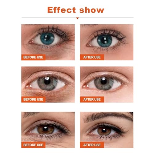 All Natural Anti-Wrinkle Eye Serum Oil for Dark Circles and Firming, 3 Pack - Image 3