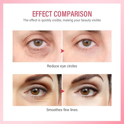 Retinol Eye Cream,Anti-Aging Eye Cream with Hyaluronic Acid and Collagen,Diminish Dark Circles,Eliminate Puffiness,Smooth Fine Lines,Enhances the Elasticity of the Eye Area. - Image 6