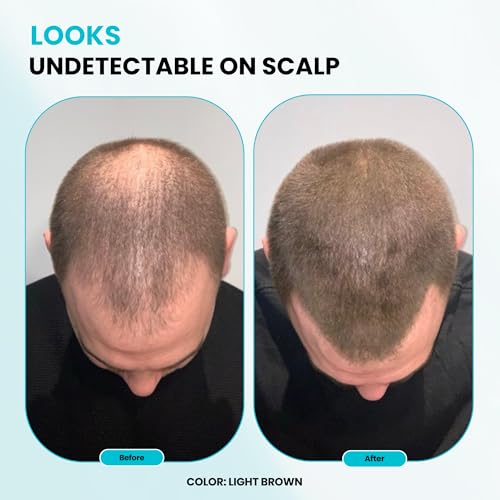 SURETHIK 30g Grey Hair Building Fibers for Instant Volume Thinning Hair Men Women - Image 5
