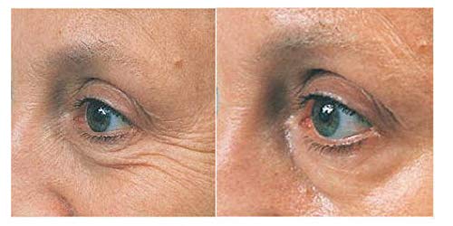 DER-MAX-YL (Palmitoyl Hexapeptide-12)- Mix in with your favorite cream, gel, lotion or serum to make your own skin care solution. FOR THE REDUCTION OF DEEP WRINKLES, CROWS FEET AND UNDER THE EYES (20 ml) - Image 2