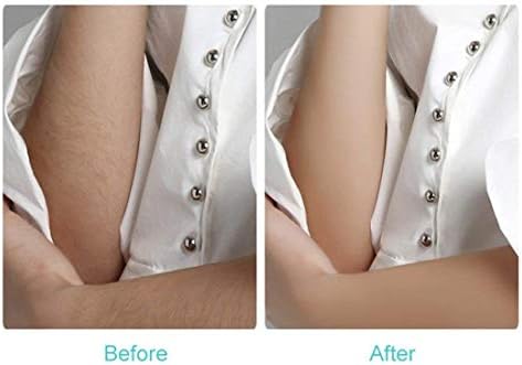 Rechargeable Epilator for Women with Sensor Light for Effortless Hair Removal Tools - Image 4