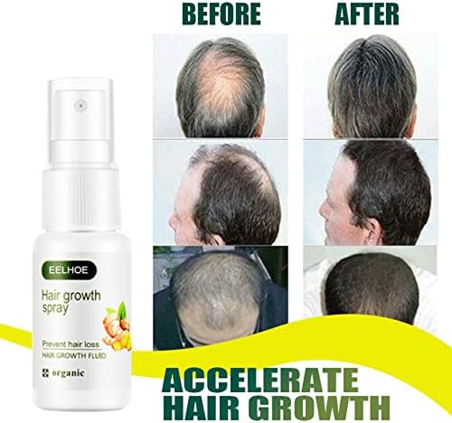 Ginger Spray, Ginger Hair Growth Spray, Ginger Spray Stop Hair Loss Hair, Thinning Treatment Hair Growth Spray for Women & Men - Image 3