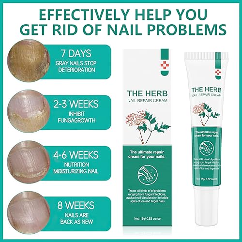 Nail Repair Cream, Nail Strengthener Cream, Nail Repair Solution, Repairs Damaged, Broken, Cracked and Discolored Nails - Image 3