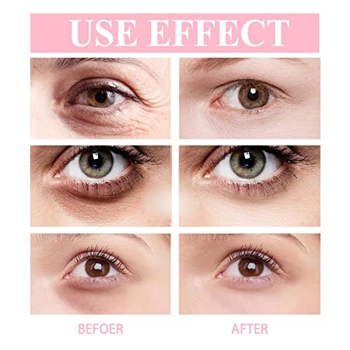 2 Pcs Hydrating and Brightening Eye Balm, Anti-wrinkle Eye Cream Stick, Dark Circle Fine Lines Treatment, Under Eye Serum Balm Skin Care - Image 4