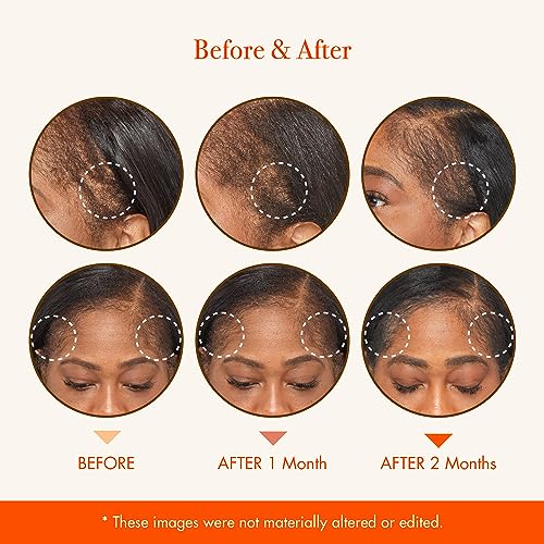 RED by Kiss Biotin & Rosemary Hair Growth Ampoule - Image 6