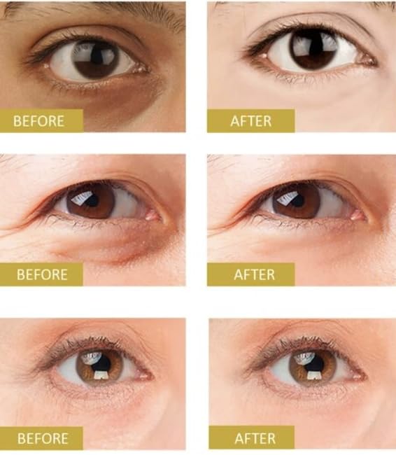 Organic Triple Firming Eye Lift Gel 1 OZ for Enhanced Firmness and Lasting Hydration - Image 4