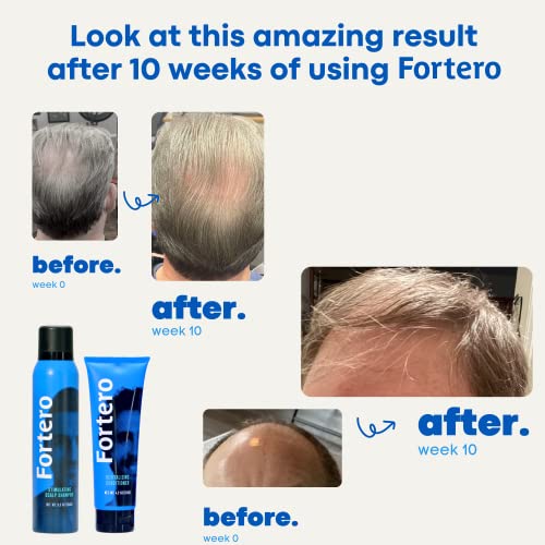 Fortero Revitalizing Conditioner for Hair Growth – Thickens, Moisturizes & Smooth for Thinning Hair and Hair Growth (1 Pack) - Image 4