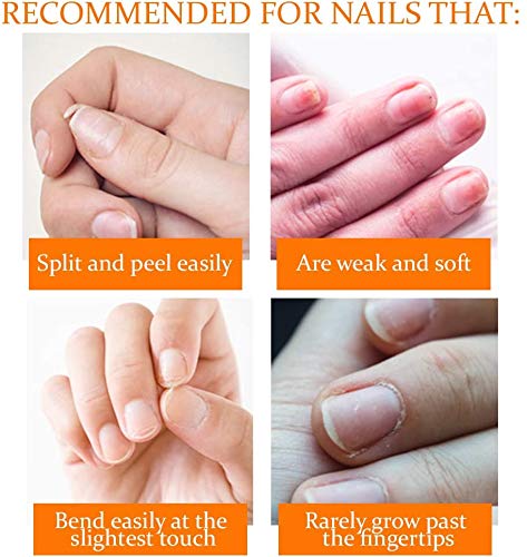 Nail Tek Repairs Damaged Nails kit.Intensive Therapy(.5OZ),Foundation(.5OZ)& Renew(.48OZ) - Image 4