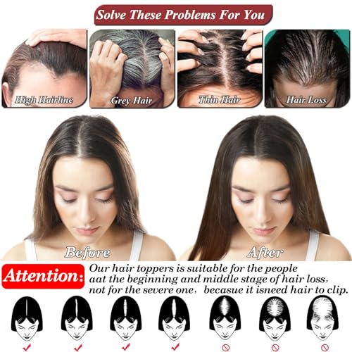 JGS1996 150% Density Real Human Hair Topper for Women, Lace Base, Clips Included - Image 5