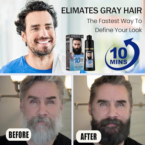 Black Beard Dye 200ml for Fast 10-Minute Coverage with 3-in-1 Formula - Image 2