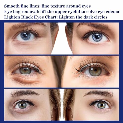 Instant Eye Lift, Eye Instant Eye Bag Eraser, Eye Cream Instant Eye Lift Smooth Wrinkles, Fade Fine Lines, Smooth Wrinkles, Tighten Saggy Skin, & Brighten Complexion (2Pcs) - Image 5