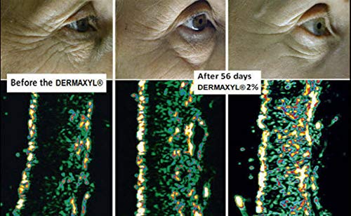 DER-MAX-YL (Palmitoyl Hexapeptide-12)- Mix in with your favorite cream, gel, lotion or serum to make your own skin care solution. FOR THE REDUCTION OF DEEP WRINKLES, CROWS FEET AND UNDER THE EYES (20 ml) - Image 4
