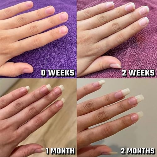 Radiant Nail Growth Oil, Radiant Cosmetics Nail Growth Oil, Nail Growth Serum, Cuticle Oil for Nails, Nail Strengthener and Growth Polish, For Moisturize Strengthen Brighten Nails Care (2) - Image 3