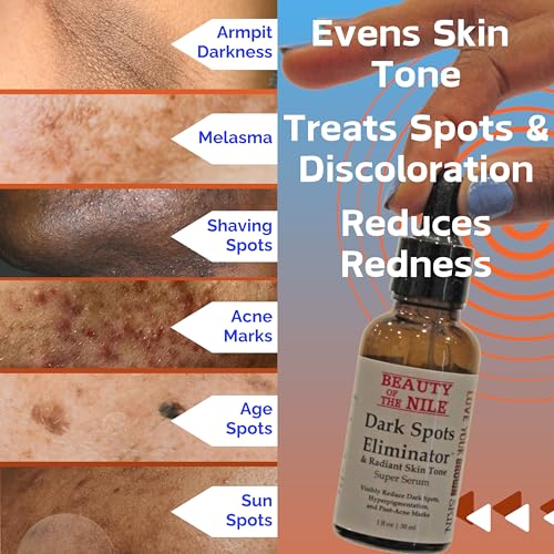Dark Spots Eliminator™ Serum for Skin-of-Color, Remover Face Hyperpigmentation Age Acne Retinol Niacinamide Hyaluronic Acid, Beauty of the Nile® 1 Oz - Image 3