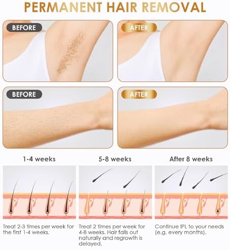 at-Home Hair Removal for Women and Men, Permanent Painless Best Hair Remover Device Whole Body Facial Armpits Back Legs Arms Face Bikini Line, Corded (XL) - Image 5