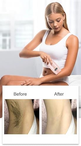 at-Home Hair Removal for Women and Men, Permanent Painless Best Hair Remover Device Whole Body Facial Armpits Back Legs Arms Face Bikini Line, Corded (XL) - Image 7