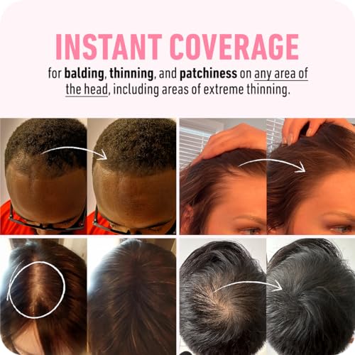 BOLDIFY Hairline Powder - LARGER 10g Bottle - Root Touch Up Powder - Instantly Conceals Hair Loss - Hair Toppers for Women & Men, Hair Powder for Thinning, Stain-Proof 48 Hour Formula (Black) - Image 3