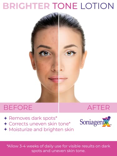 Natural Ingredients 30ml Brightening Dark Spot Corrector for Hyperpigmentation - Image 5