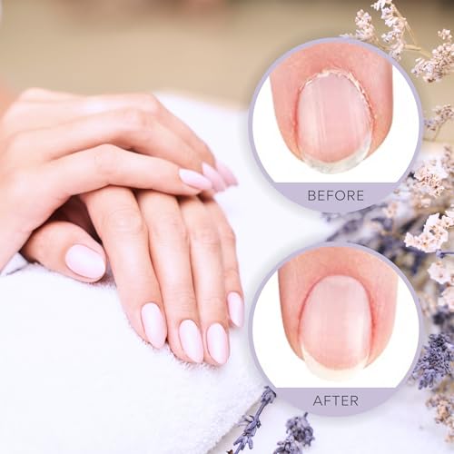 C CARE Sweet Almond Roll-On Cuticle Oil | Natural Revitalizing Hydrating Nail Oil For Repaired Cuticles Overnight | Remedy For Damaged Skin And Thin Nails | Paraben Cruelty Free Formula | 10ml - Image 7
