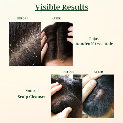 Cultivator's Anti Dandruff Hair Mask|Deep Conditioning Hair Mask for Dandruff & Dry Scalp|Hydrating & Soothing Hair Mask for Itchy & Flaky scalp | Dry scalp treatment Organic leave in repair Hair mask - Image 6