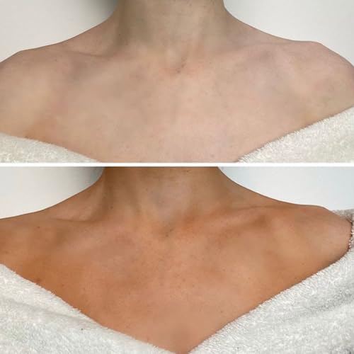 Dermatologist Approved Dark Skin Self-Tan Mousse 200ml Easy Application - Image 5