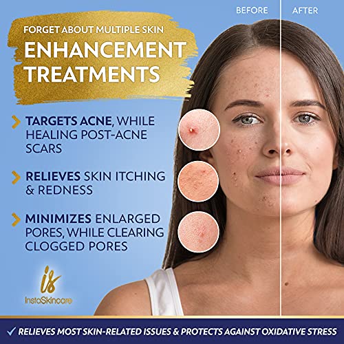 DOUBLE SIZED (2Oz) Niacinamide Serum for Face 10% with Zinc 1% Vitamin B3 Brightening Serum for for Tone, Texture and Hydrating - Image 5