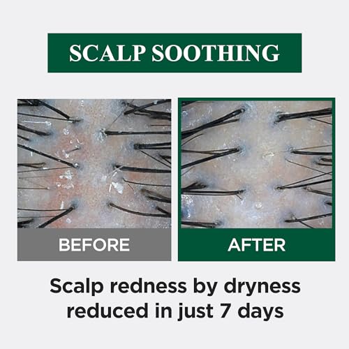 Dr. Groot Sensitive Scalp Microbiome Shampoo 13.5 fl oz with Cica, Cypress, BHA, Biotin - Image 3