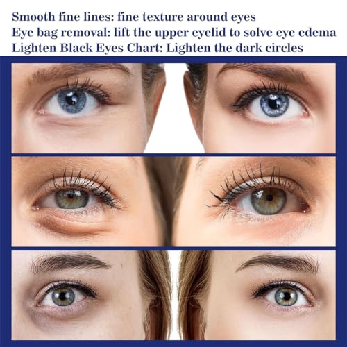 Glozie Instant Eye Lift, Eye Cream, Instant Firmx Eye Tightener, Eye Bag Remover, Eye Wrinkle Cream for Women, Anti-Aging Eye Cream, Smooth Wrinkles, Tighten Skin & Brighten Complexion - Image 4